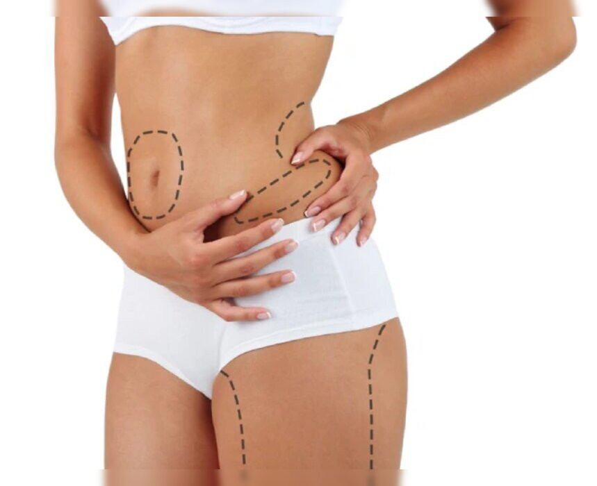 liposuctiontreatmentinnavimumbai2.jpg