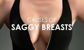 causessaggingofbreasts.jpg