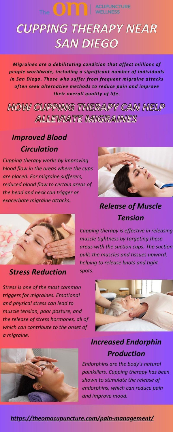 howcuppingtherapynearsandiegocanhelpalleviatemigraines.jpg