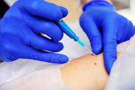 electrosurgerymarket4.jpg