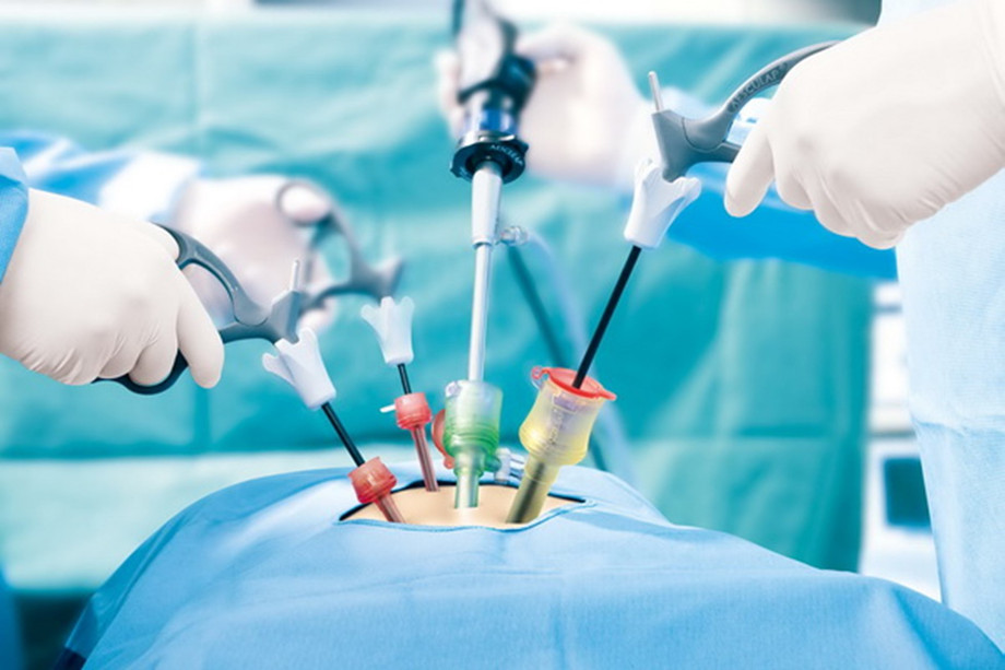 howlaparoscopicsurgeryhastakenoveropensurgery_1.jpg