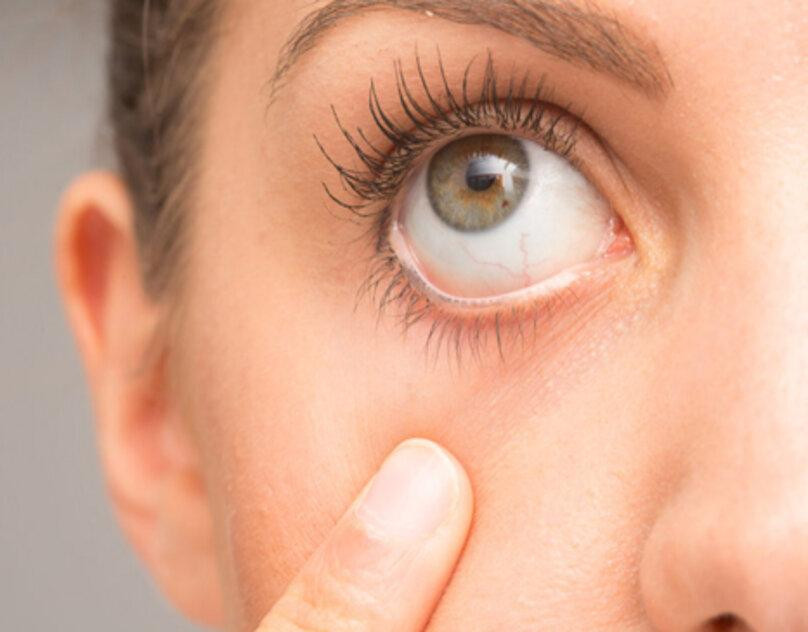 childeyecare11.jpg