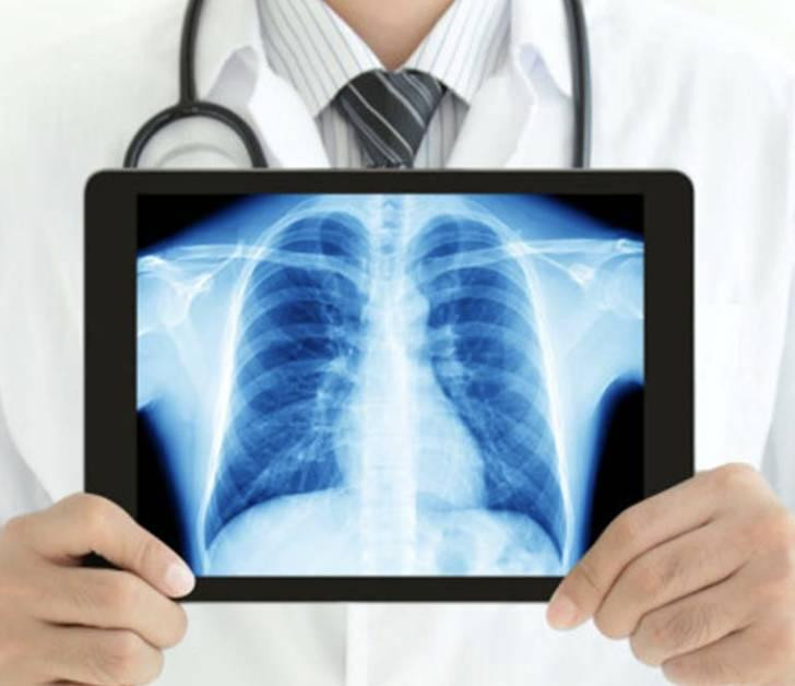 getadvancedxrayservicesinrwandaatfrontierdiagnosticcentre.jpg