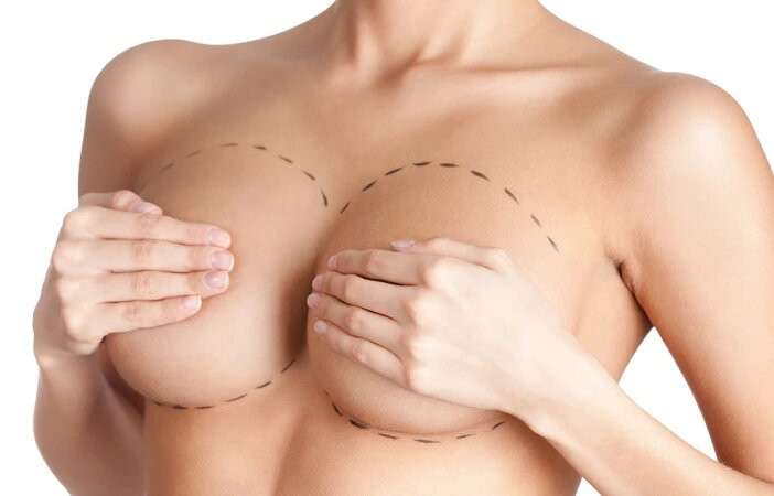 costofbreastenlargementsurgery.jpg