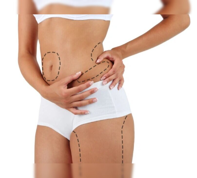 liposuctiontreatmentinnavimumbai.jpg