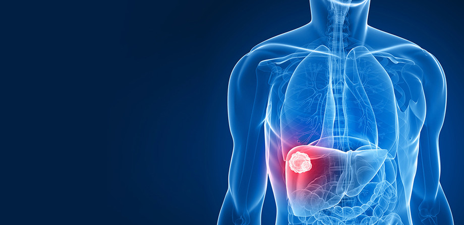 livercancertreatment1.jpg