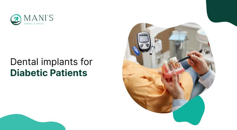 dentalimplantsfordiabeticpatients.jpg