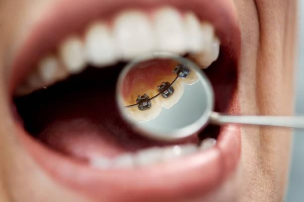 orthodontistinthousandoaksca.jpg