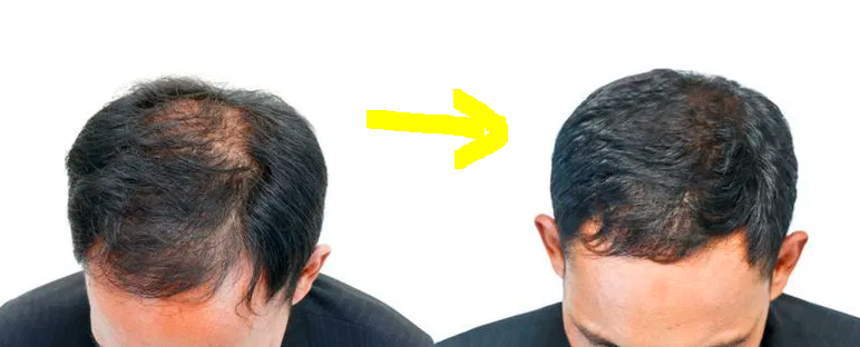 image21.png