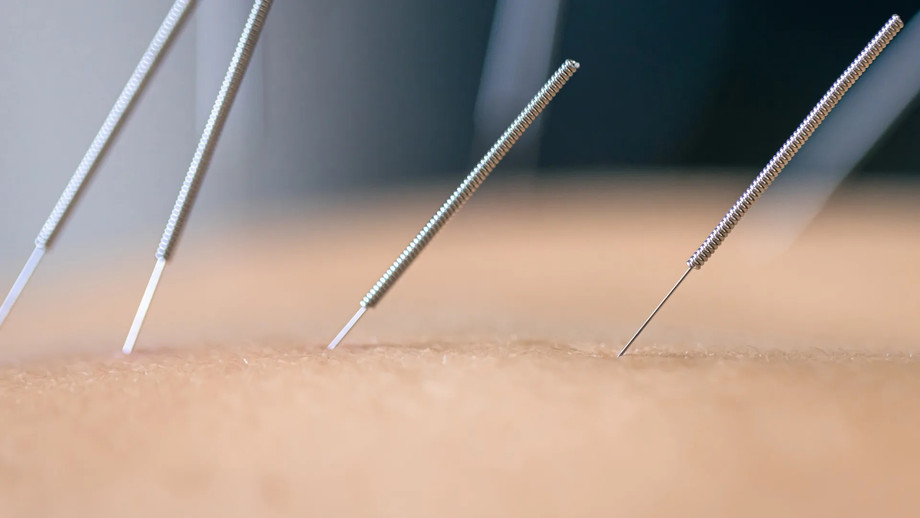 imgi_10_bannerimageacupuncturejpg.jpeg