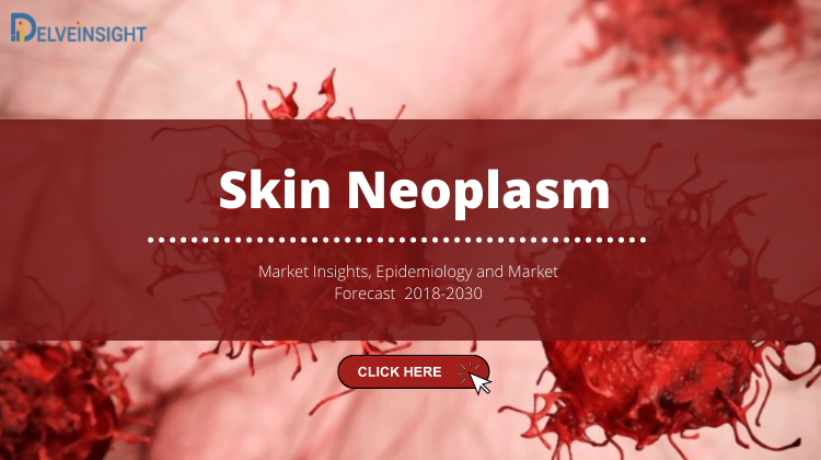 skinneoplasmmarket.png