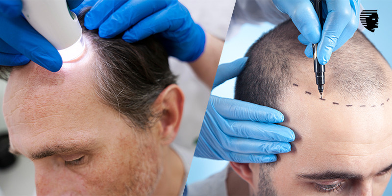 hairrestoration.jpg