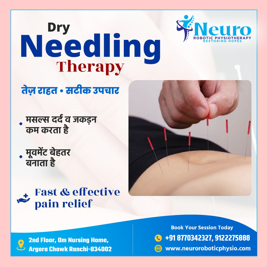 dryneedlingtherapyranchineurophysiotherapyjpg.jpeg