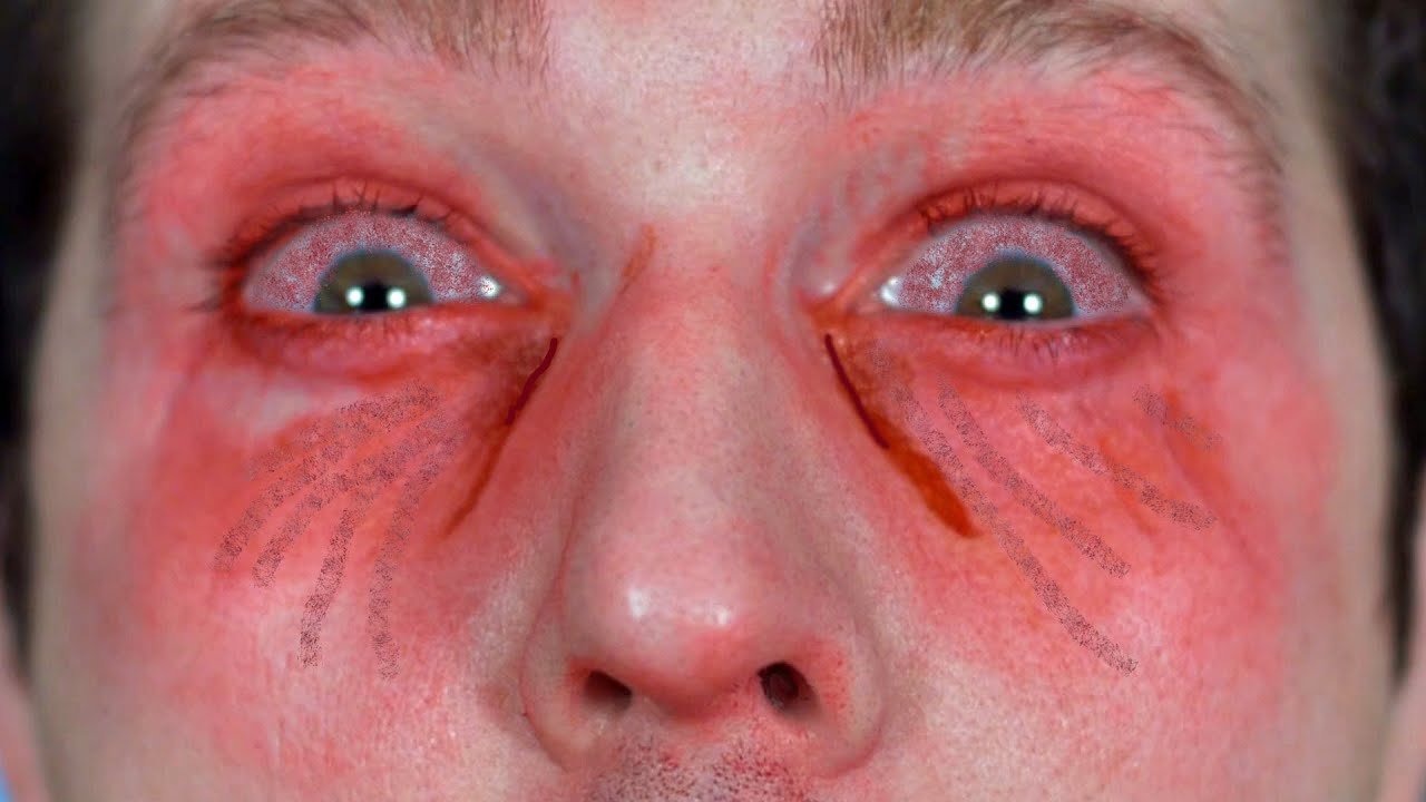 Video thumb